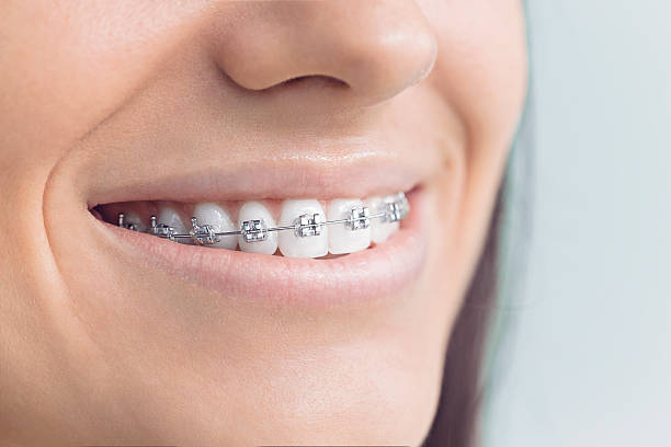 Trusted Aberdeen, OH Holistic Dental Care Services Experts
